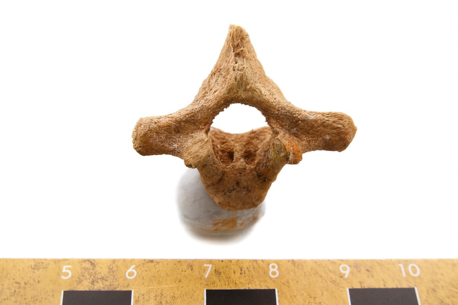 Bones 